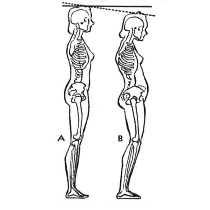 Alexander Technique